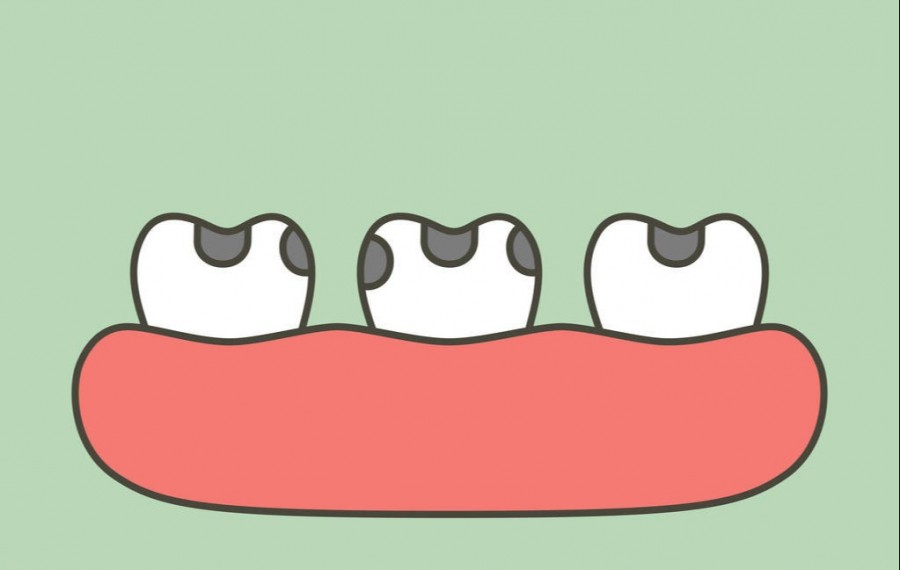 大牙蛀牙补救方法,儿童蛀牙掉牙哭的视频