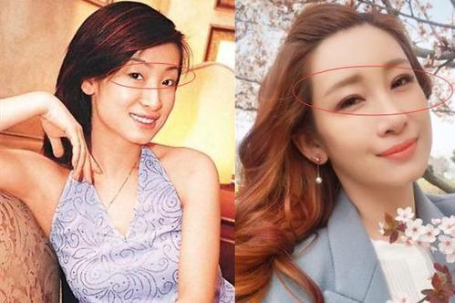 看过邓伦的丹凤眼和刘昊然的三角眼，还要都变成双眼皮吗