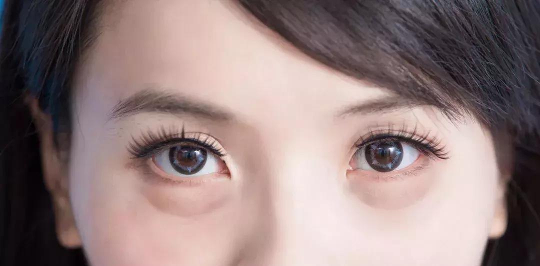 卧蚕越来越不明显的原因,卧蚕越来越明显的原因