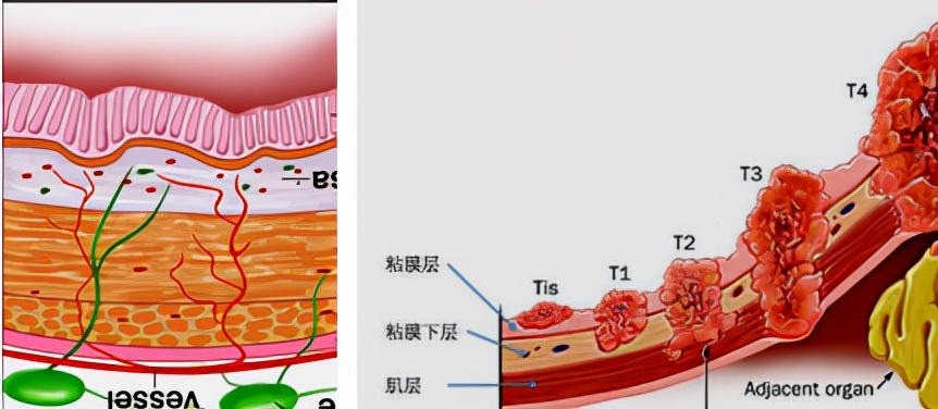 我不是药神，我不是财迷！若患胃癌，这些靶向药你有能力负担吗？