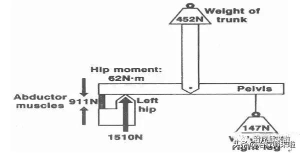 常见的异常步态醉酒步态,步态异常的十大特征有哪些图片
