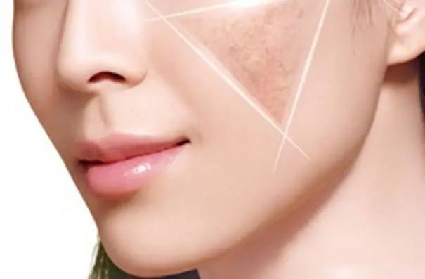 脸上斑点很多祛斑最有效的办法,皮肤不好有斑怎么祛斑