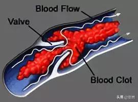 被忽视的粗粮营养,被忽视的营养素