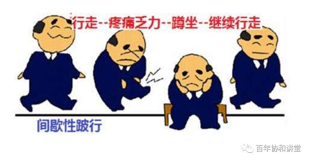 腰腿痛走路可以缓解是什么病,腰椎管狭窄腿疼晚上为啥疼得厉害