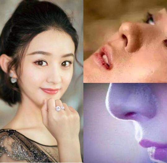 脸颊毛孔变粗有办法解救吗,脸颊器质性毛孔粗大