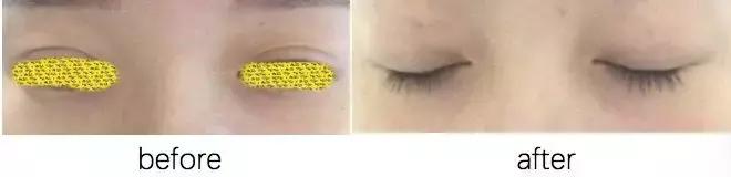 灏忕櫧涔熻兘闂溂鍏ョ殑鍖荤編椤圭洰,鍖荤編涓殑绱犻缇庤倢椤圭洰