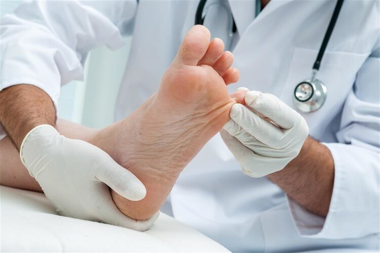 脚底长了鸡眼怎么去掉,脚底长了鸡眼不想挖怎么办