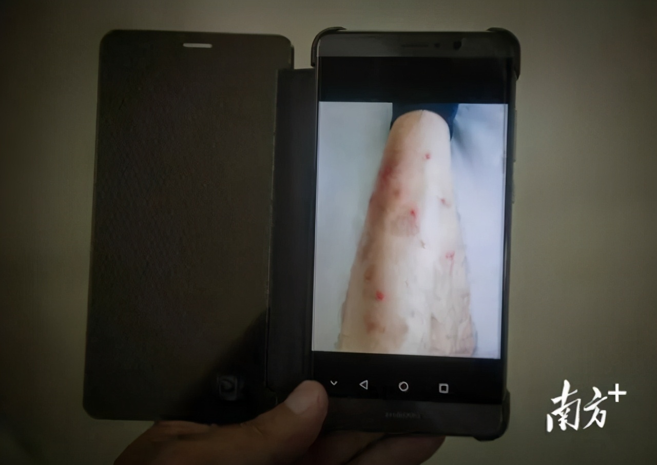 很毒！碰到这种小土堆躲远点