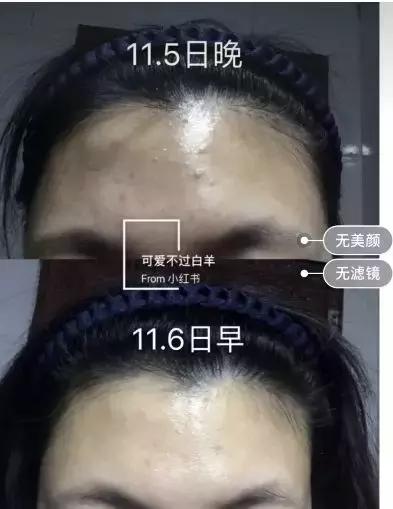 护肤成分合集你懂吗,必须要知道的护肤成分避免踩坑