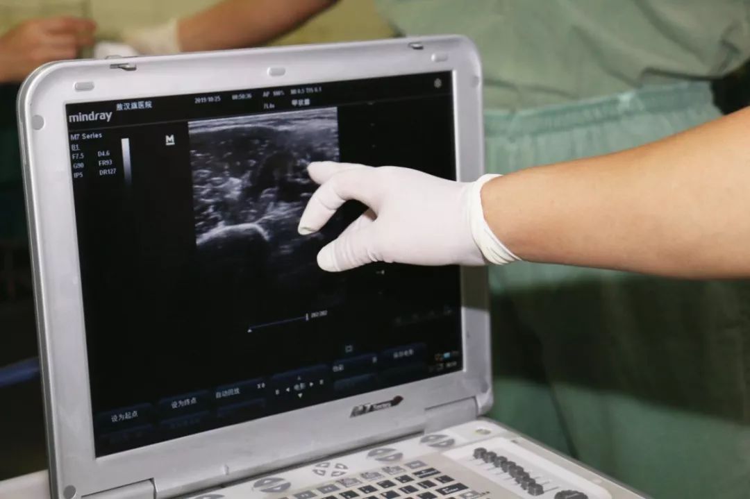 敖汉旗医院麻醉科开展超声引导下神经阻滞术