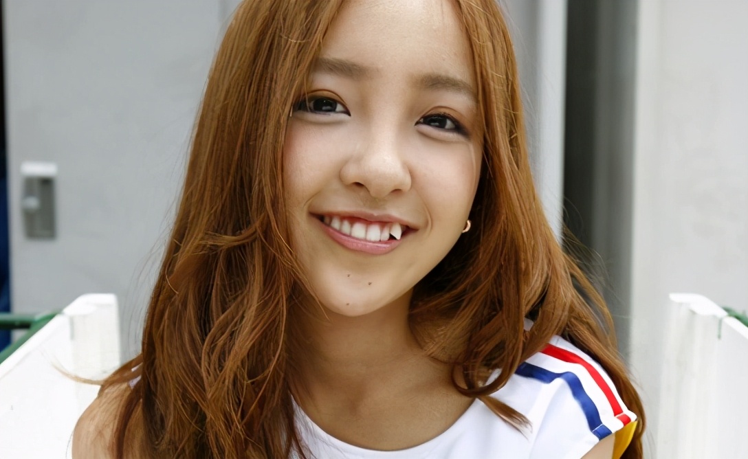 为什么有些人会长獠牙,为什么有的人成年了还会长牙