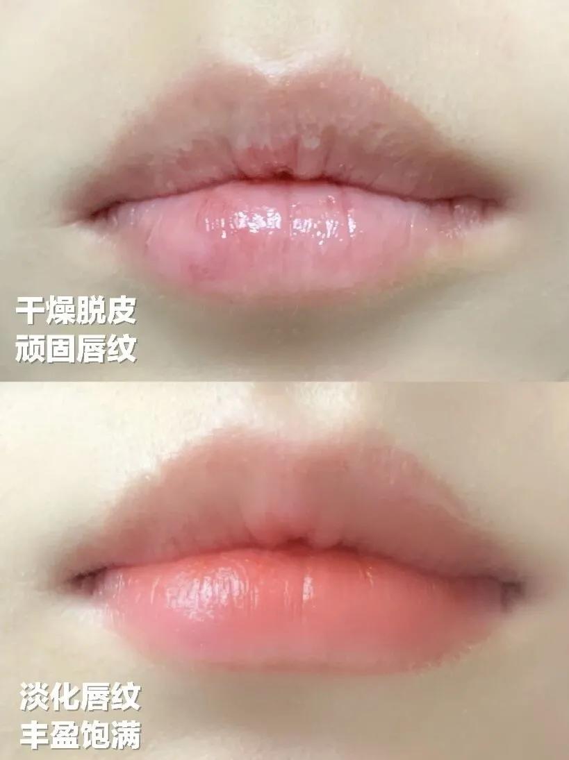 嘟嘟唇如何养成学生党,如何养成粉色嘟嘟唇