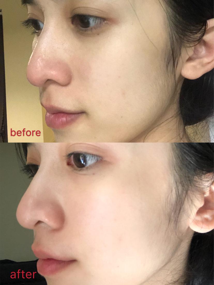 零毛孔让你的皮肤光滑细腻,教你一招搞定毛孔