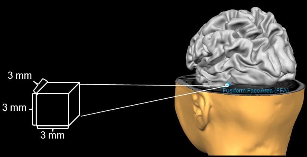 脑功能成像和血管成像,核磁共振脑成像mra是查什么的