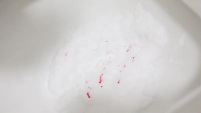 如何避免拉屎溅到屁股,如何避免拉屎时水溅到屁股上