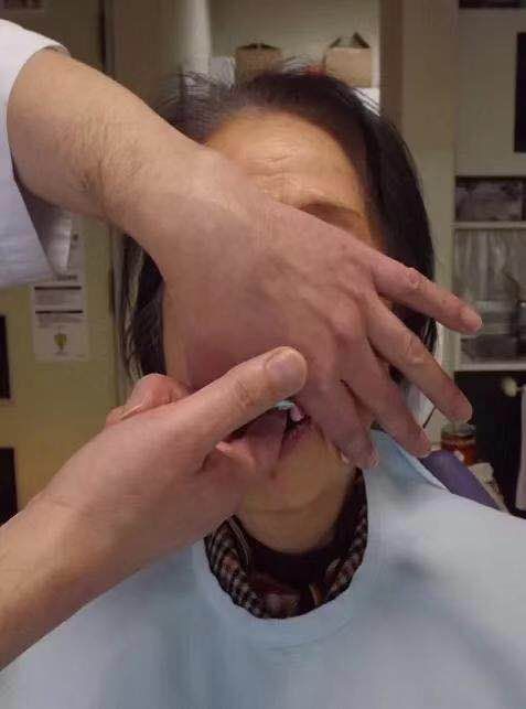 咬合重建的程序,咬合重建做嵌体