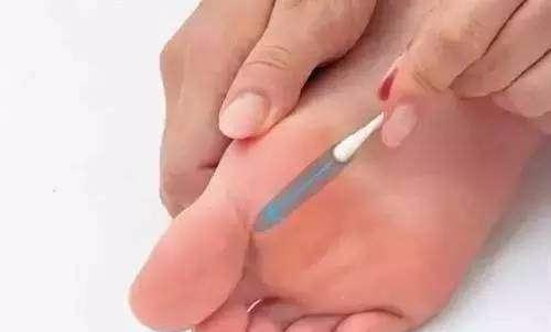 一个小妙招全身的痛都能治,一根棉签的效果视频