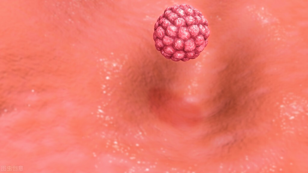 附件炎是卵巢发炎吗,附件炎或者盆腔炎的症状