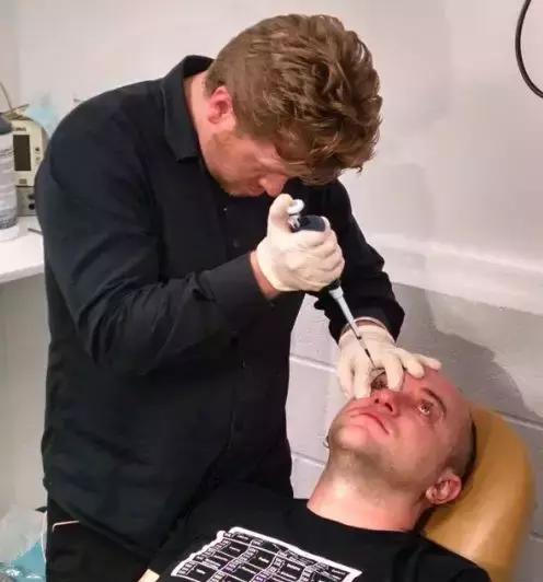 美国黑科技眼药水,美国研制的近视眼药水