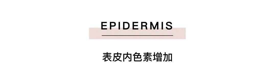 色斑皮肤问题及护肤解决方法,色斑护肤知识