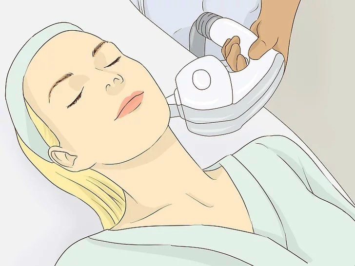 如何去除笑纹,表情纹跟笑纹怎么去除