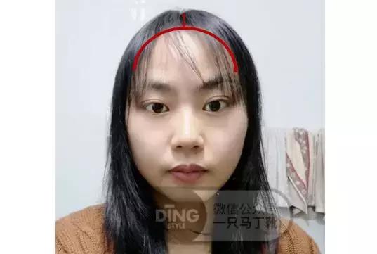 颅顶太低如何自救,颅顶低怎么自救