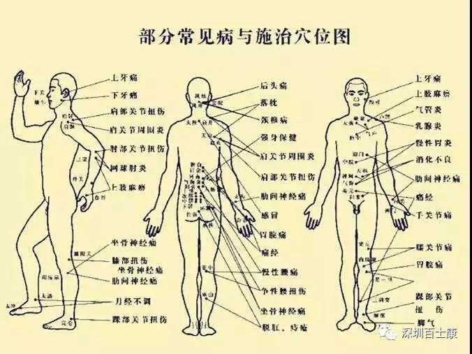 肌筋膜疼痛讲的是什么,最全肌筋膜触发点图解