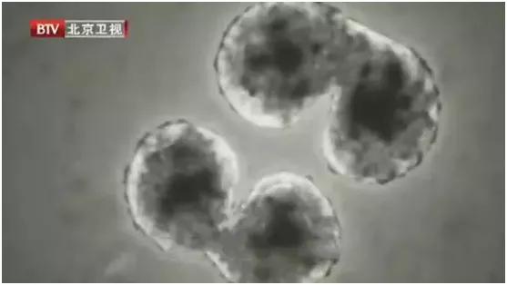 这5种炎症可能会演变成癌症,炎症发展成癌症的几率有多大