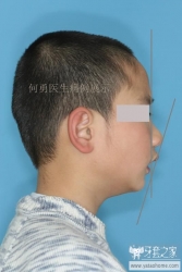 正畸医生如何指定方案的,正畸医生怎么说