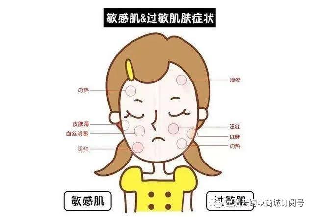 皮肤干燥怎么办吃什么药最好,皮肤干燥怎么办才能改善