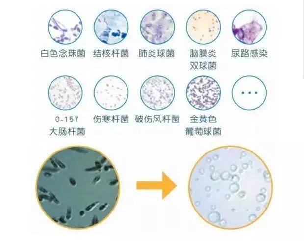 夏天出汗有体味是怎么回事,夏天出汗有异味吃什么药