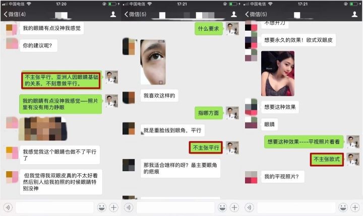 双眼皮整形的真实经历,为什么做双眼皮医生术前不沟通