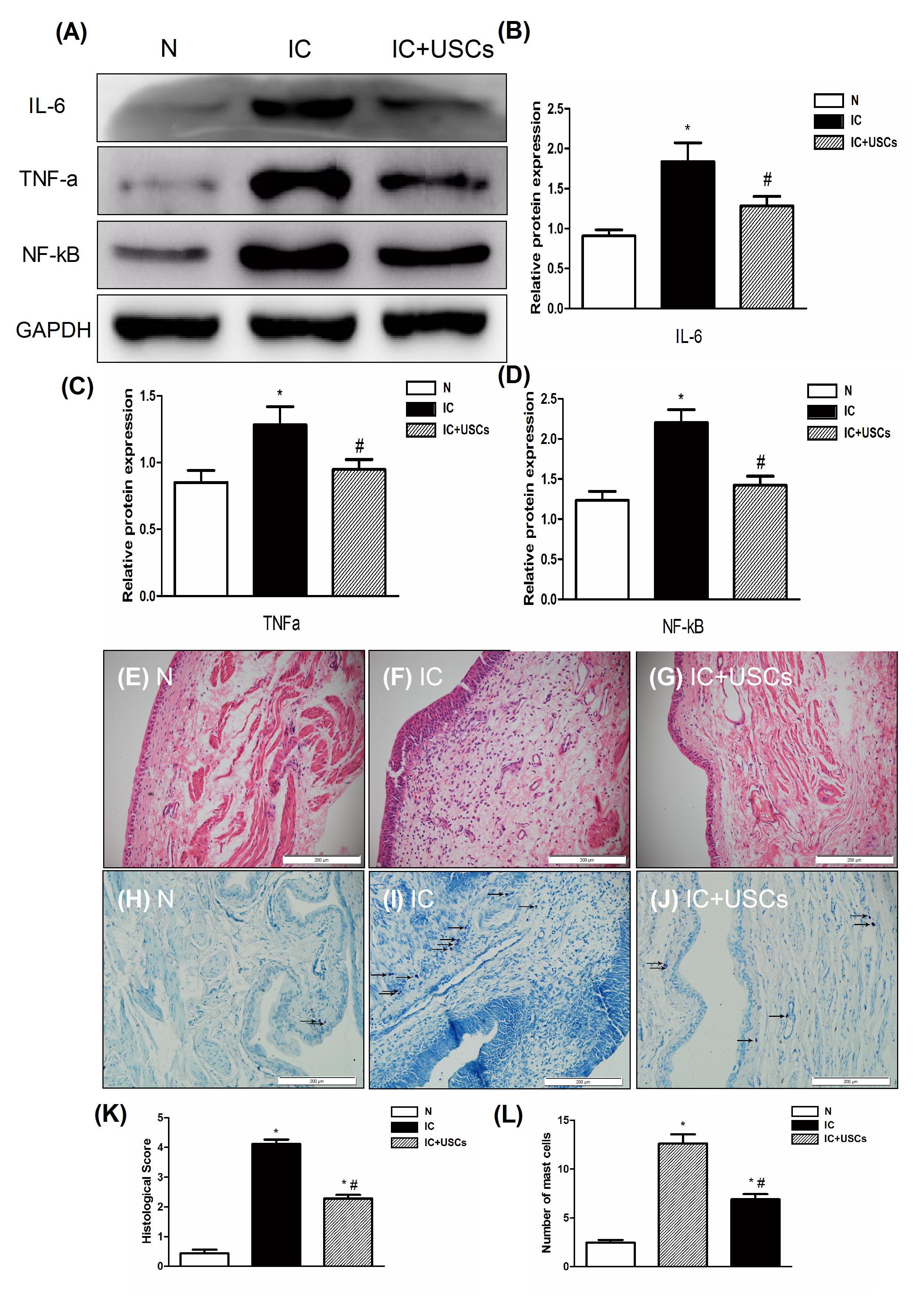 光动力治疗间质性膀胱炎,干细胞治疗间质性肾炎