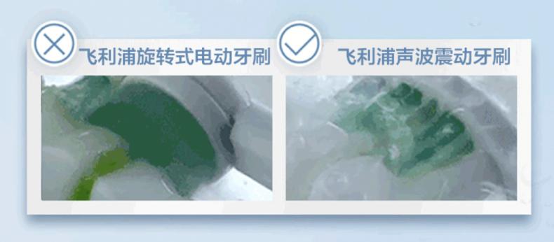 电动牙刷推荐,欧乐电动牙刷值不值得入手