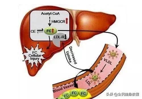 脂肪怎么分解和排出体外不运动,脂肪怎么除