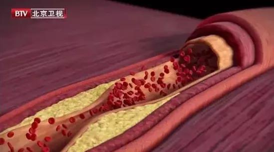 7个不起眼的坏习惯，可能从头到脚伤害你！第三个就有很多人中招