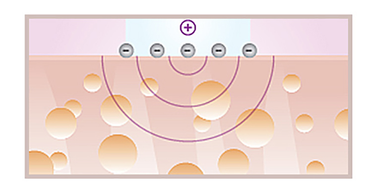 干皮想要美白有妙招，做好以下几点就够了，助你恢复白嫩肌肤