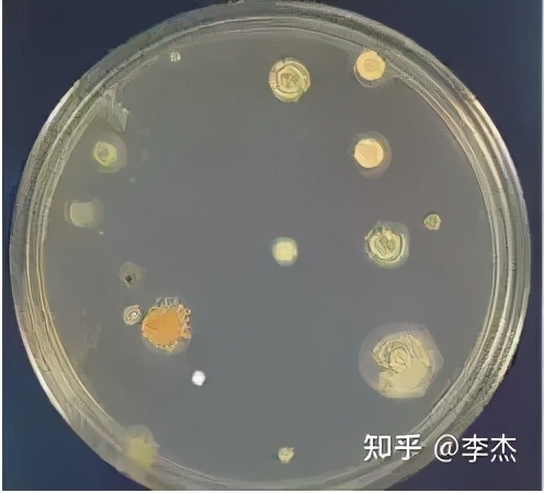 细胞被支原体污染怎么处理,细胞培养如何应对支原体污染