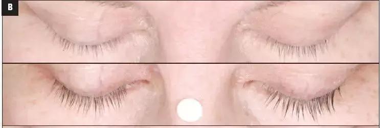 吴谨言迪丽热巴对比惨烈,热巴年纪更小却因这个bug显老10岁?