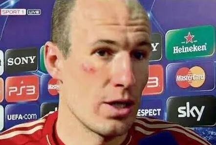 罗本和里贝里看拜仁比赛,2010欧冠决赛罗本失点球