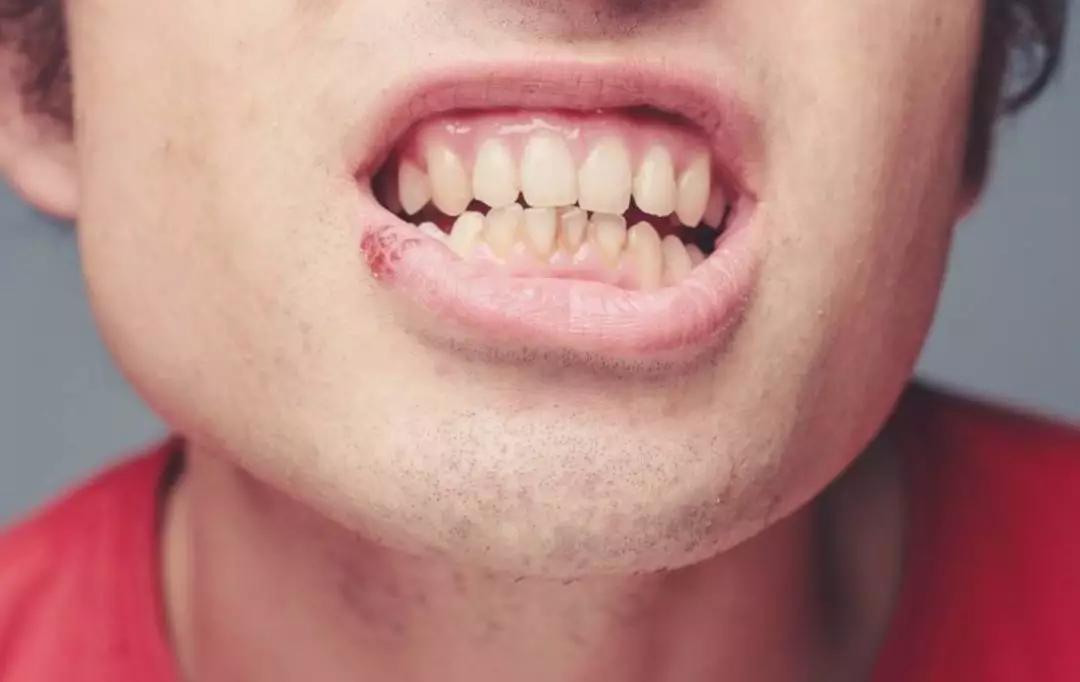 哪里长带状疱疹最危险,孕妇长疱疹咋办