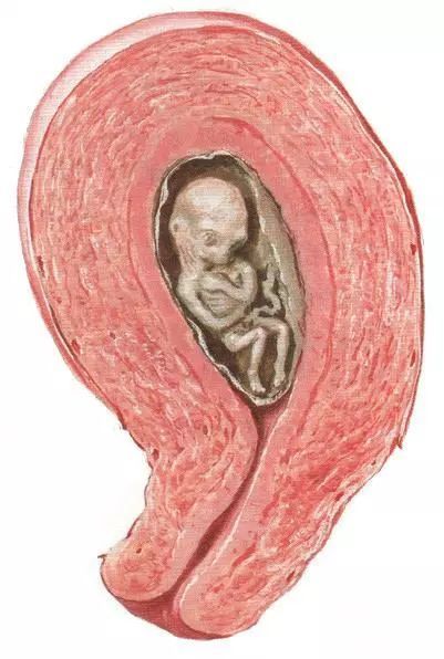 胚胎停育需不需要检查胚胎染色体,胚胎停育可能性大还有希望吗