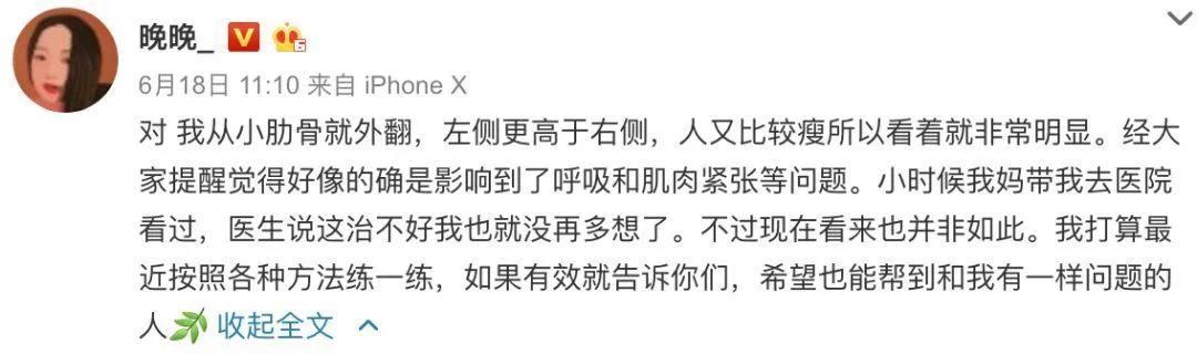 肋骨外翻且胸部突出,肋骨外翻导致胸突出