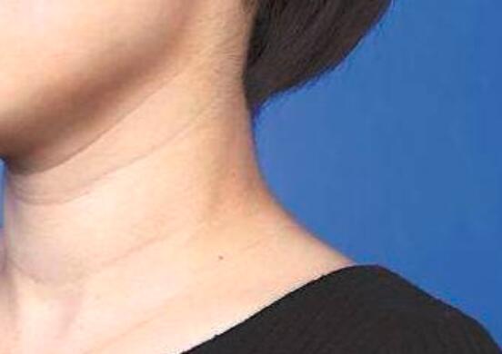 脖子有颈纹怎么化妆,脖子有颈纹的人怎样