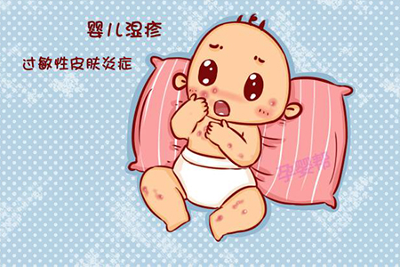 热疹湿疹和过敏的区别,宝宝过敏引起的湿疹怎么办
