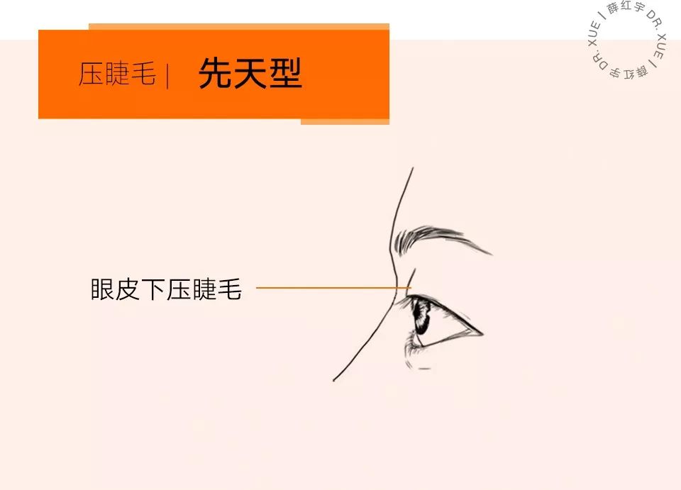 睫毛卷翘的方法半永久,睫毛卷翘定型