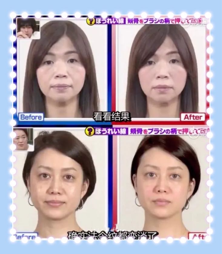 还不到30岁的郑爽，法令纹就这么明显了？*力暴**按摩，她的脸没事吧