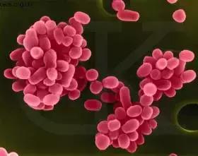 人有艾滋病的话有什么特征,狗狗会不会得艾滋病