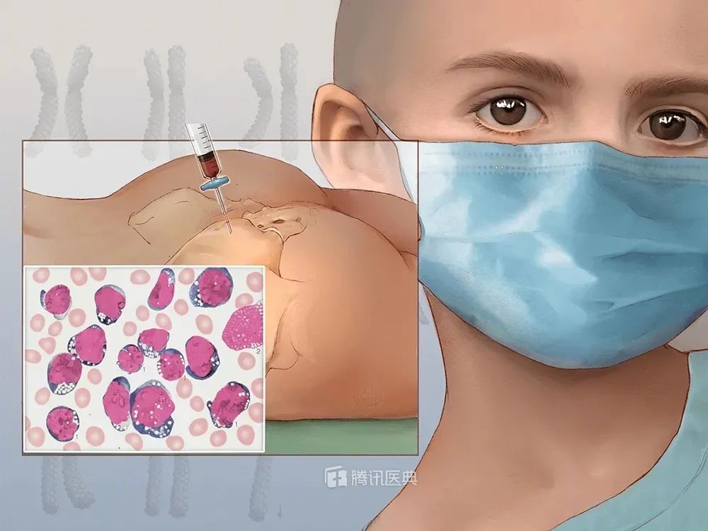 娃一天流3次鼻血,用纸巾堵住后竟吐血!这些止血法太坑娃