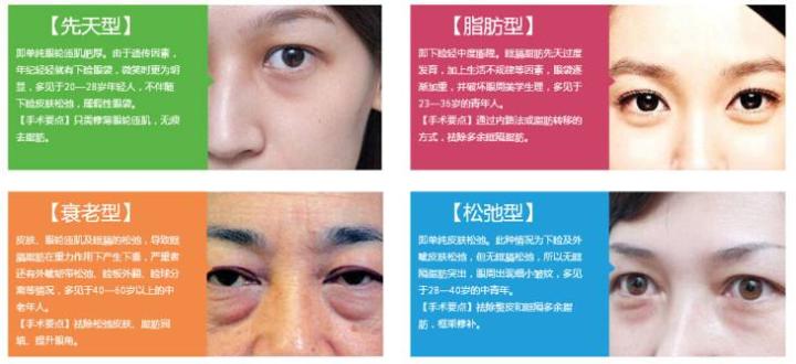 有眼袋怎么办按摩去眼袋,去眼袋眼霜真能去眼袋吗